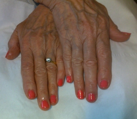 Tropix Shellac