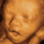 this is my: 4D baby scan in Hull