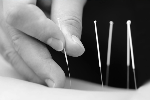 Medical Acupuncture